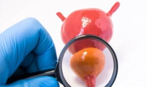 Καρκίνος του προστάτη: Τα πρώτα σημάδια που δεν πρέπει να αγνοεί κανείς – Γιατρός του Χάρβαρντ προειδοποιεί