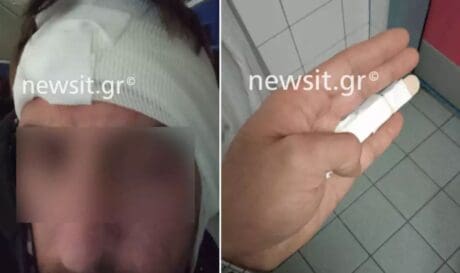 οδηγός ντελίβερι ακρωτηριασμός αυτί Πέλλα