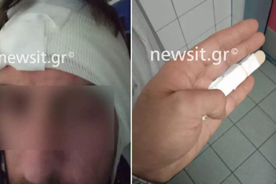οδηγός ντελίβερι ακρωτηριασμός αυτί Πέλλα