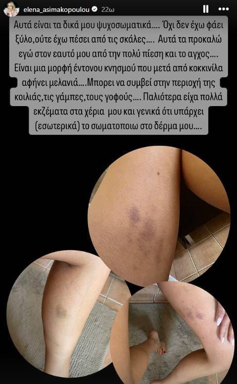 Έλενα Ασημακοπούλου