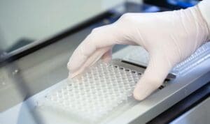 Καρκίνος παγκρέατος: Η συνήθεια που αυξάνει τον κίνδυνο επιθετικής μορφής της νόσου