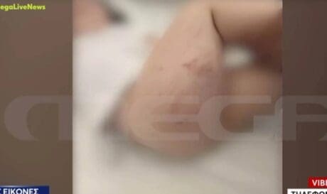 κακοποίηση 3χρονης