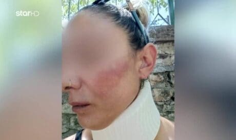 Λέσβος ξυλοδαρμός