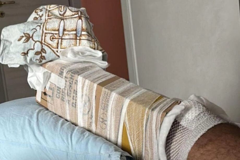 Aκινητοποίησαν σπασμένο πόδι με χάρτινο κουτί
