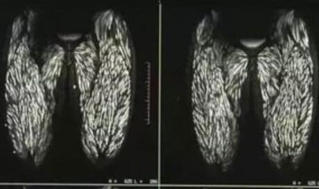 Τομογραφία