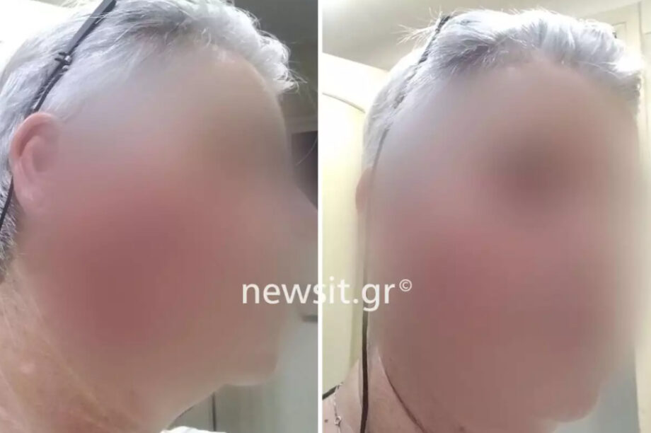 Απίστευτο ενδοοικογενειακό επεισόδιο: Την έδειρε γιατί δεν πήρε ψωμί