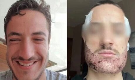 Γάλλος
