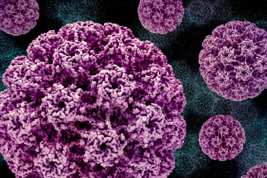 hpv κονδυλώματα