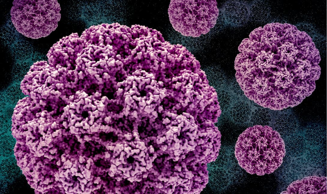 hpv κονδυλώματα