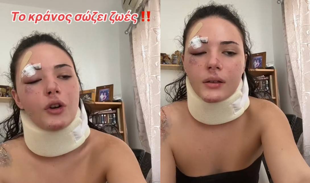 τροχαίο