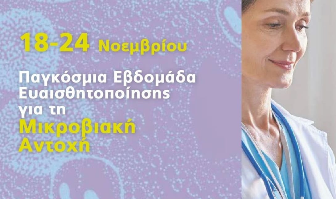 εκδηλωση