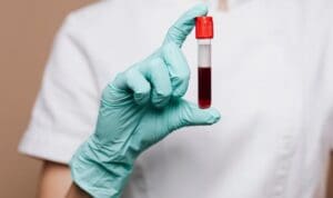 Θα πεθάνετε μέσα στα επόμενα δέκα χρόνια; Μια εξέταση αίματος μπορεί να αποκαλύψει τη αλήθεια