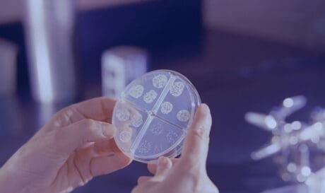 Αύξηση των κρουσμάτων φυματίωσης στην Ελλάδα!