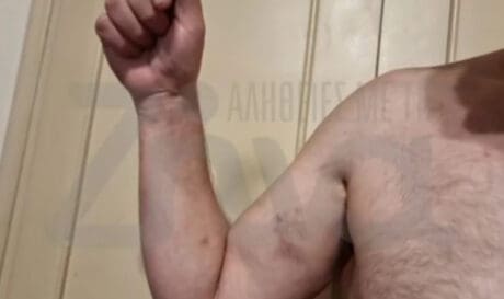 Διαβητικός καταγγέλλει ξυλοδαρμό από αστυνομικούς, τι λέει η ΕΛ.ΑΣ. (βίντεο)