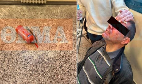 χτύπησαν με πυροσβεστήρα διδακτορικό φοιτητή σε εκδήλωση στη Νομική