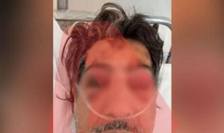 Άνω Λιόσια οδηγός λεωφορείο