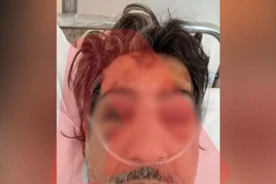 Άνω Λιόσια οδηγός λεωφορείο