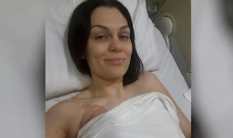 Jessie J