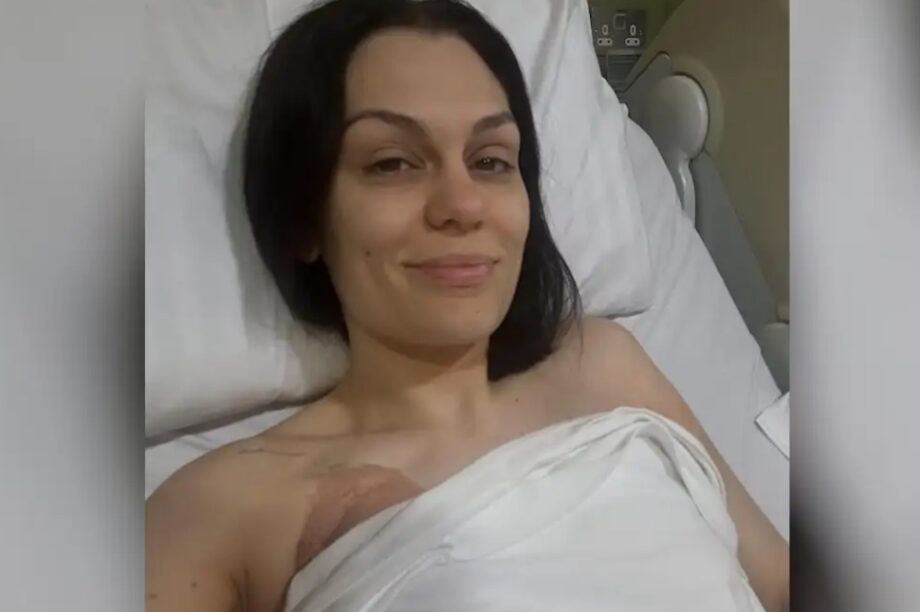 Jessie J