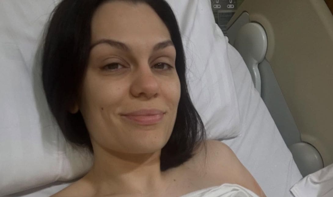 Jessie J