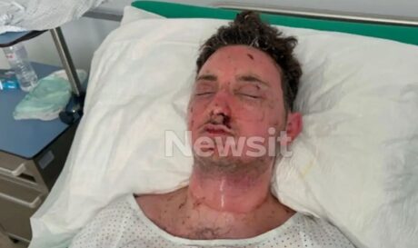 Σέρρες 19χρονος