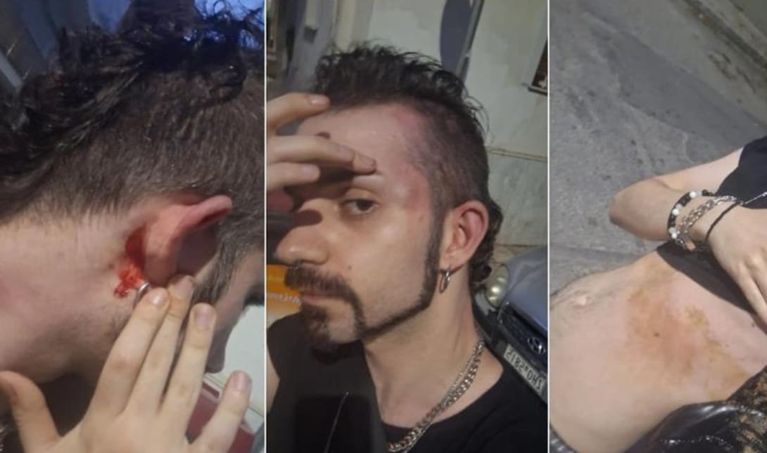 Ομοφοβική επίθεση