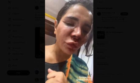 Σοκαριστική επίθεση και άγριος ξυλοδαρμός γνωστής Influencer (βίντεο)
