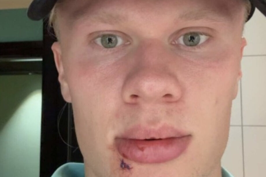 Έρλινγκ Χάαλαντ