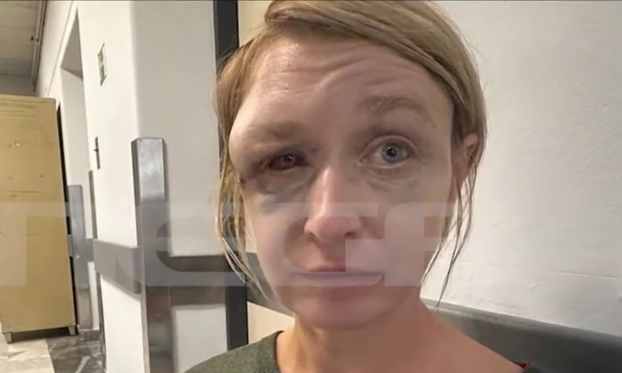 Κορωπί: «Δεν με έδειρε ο σύντροφός μου, δεν θυμάμαι πώς χτύπησα» – Τα πρώτα λόγια της Λιθουανής