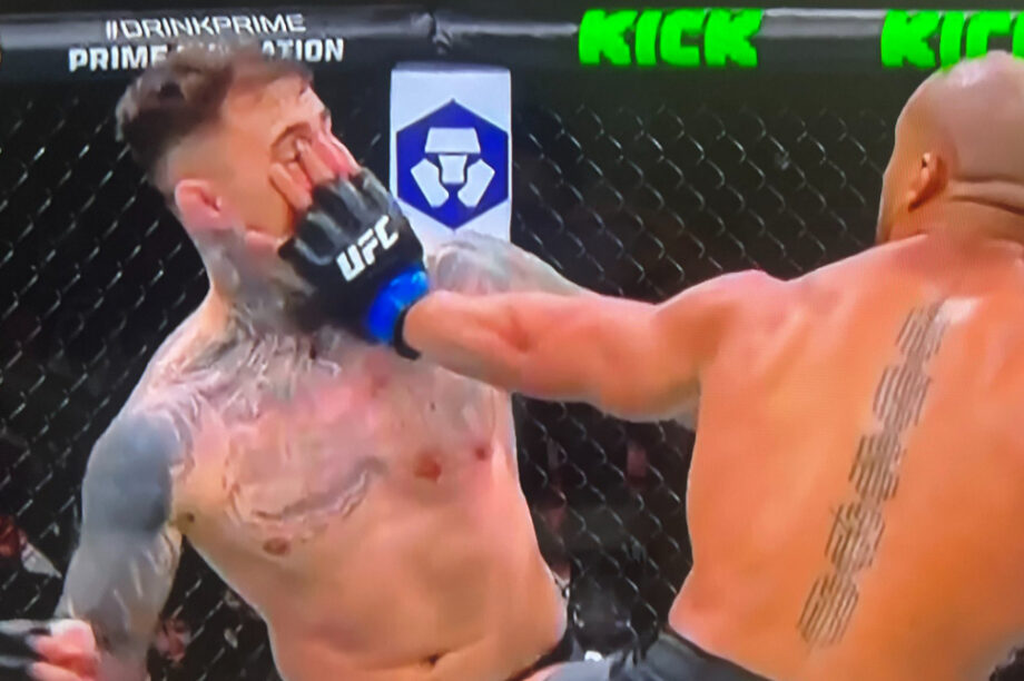 Αθλητής του UFC επιχείρησε να... βγάλει τα μάτια του αντίπαλου του! (βίντεο)