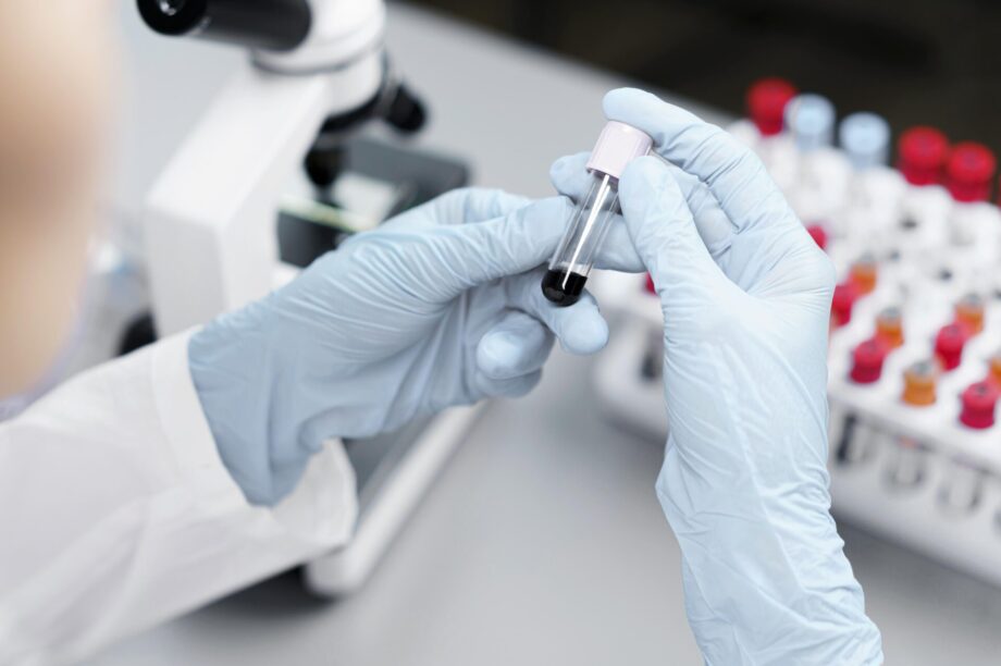 Αίμα αιματολογία