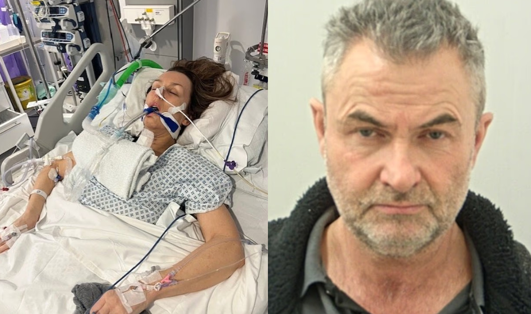 57χρονη έμεινε παράλυτη για πάντα μετά τον άγριο ξυλοδαρμό από τον σύντροφό της στη Βρετανία – Δείτε φωτο