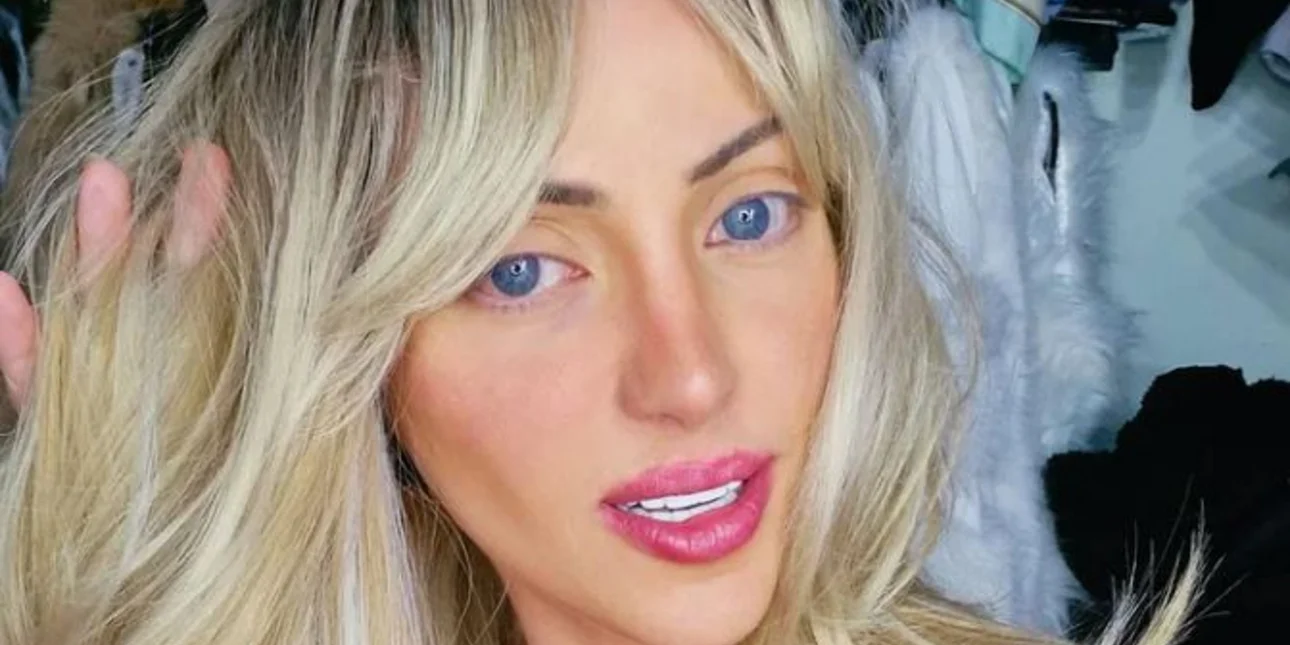 Βραζιλία: Νεκρή 31χρονη influencer που έκανε 27 πλαστικές επεμβάσεις για να μοιάσει στη Barbie