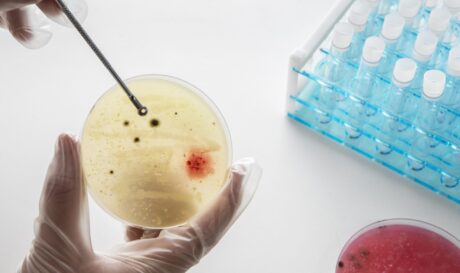 καρκίνος θεραπεία