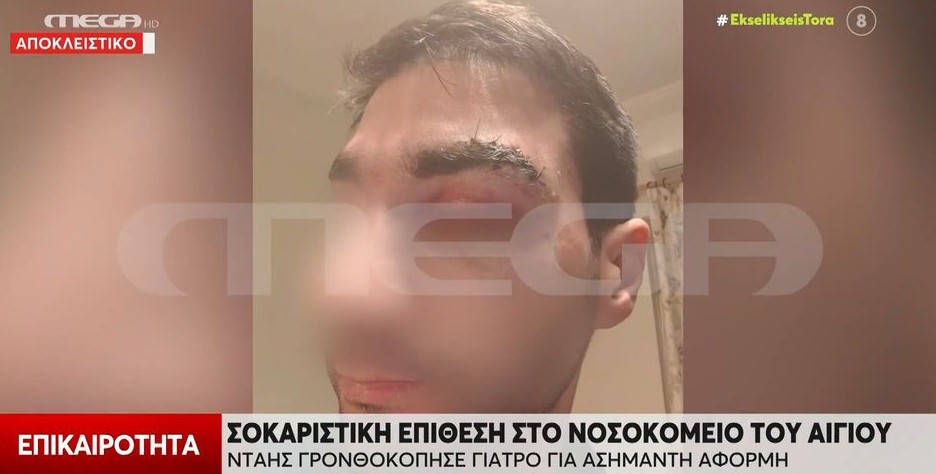 Αίγιο: «Με βάραγε για 20 λεπτά», ανέφερε ο γιατρός που γρονθοκοπήθηκε από ασθενή