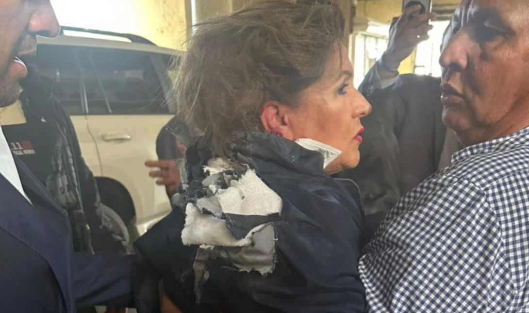 Ονδούρα: Σοβαρός τραυματισμός βουλευτή – Της πέταξαν εκρηκτικό μηχανισμό στο κεφάλι – Δείτε βίντεο