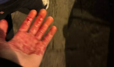 Σοβαρό επεισόδιο στη Νάπολη, μαχαιρώθηκαν δυο οπαδοί της Τσέλσι!