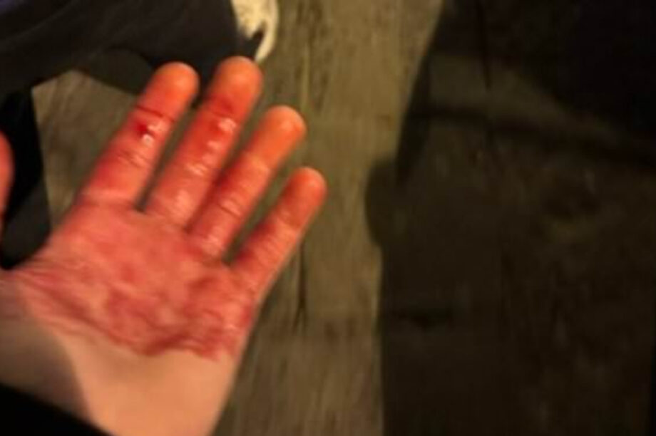 Σοβαρό επεισόδιο στη Νάπολη, μαχαιρώθηκαν δυο οπαδοί της Τσέλσι!