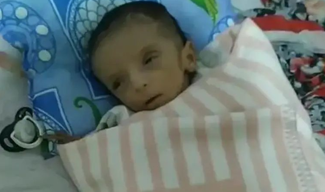Τουρκία: 2 μηνών βρέφος πέθανε από την πείνα – «Ο πατέρας μου, έλεγε “μην του δίνεις γάλα, άσ’ το να πεθάνει”» (φωτο)