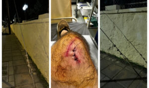 Ηράκλειο: Σοβαρός τραυματισμός πολίτη από σύρμα-παγίδα πάνω σε πεζοδρόμιο