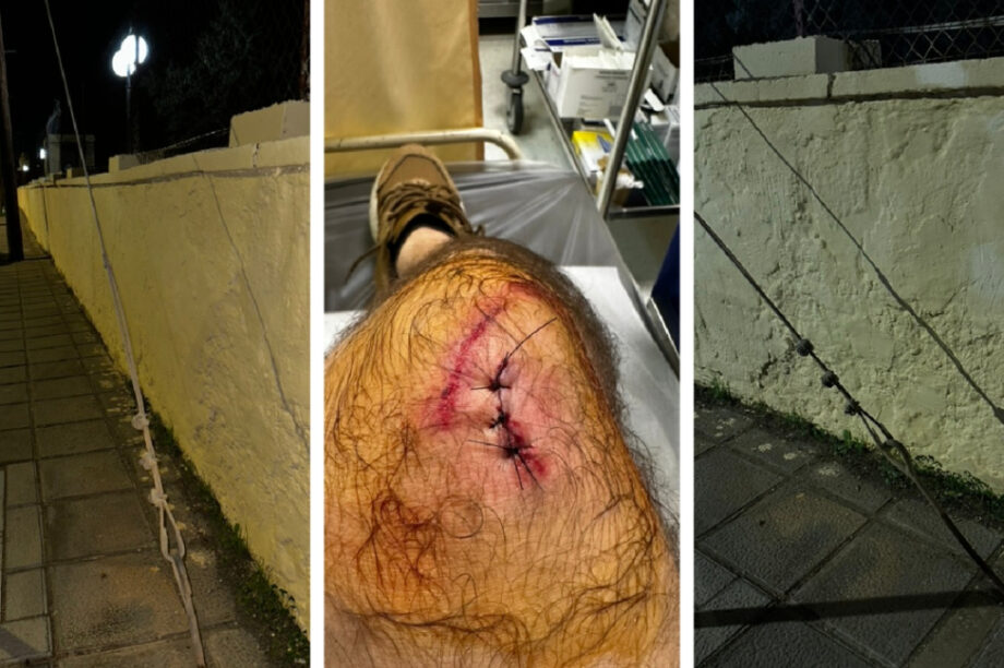 Σοβαρός τραυματισμός πολίτη από σύρμα-παγίδα πάνω σε πεζοδρόμιο