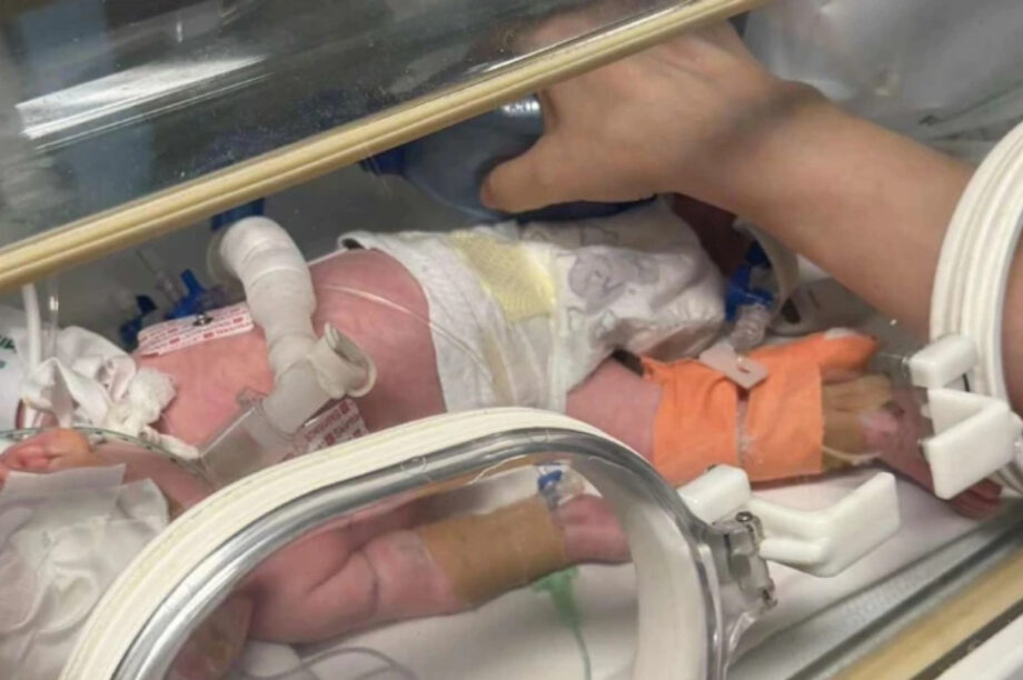 Λάρισα: Εξαιρετικά λεπτή χειρουργική επέμβαση σε βρέφος μόλις 600 γραμμαρίων στο Πανεπιστημιακό Νοσοκομείο