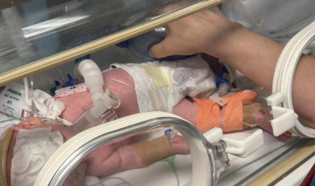 Λάρισα: Εξαιρετικά λεπτή χειρουργική επέμβαση σε βρέφος μόλις 600 γραμμαρίων στο Πανεπιστημιακό Νοσοκομείο