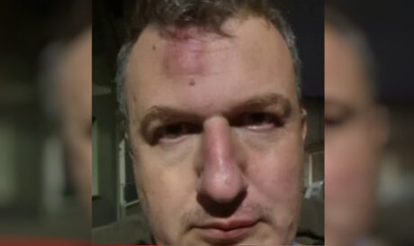 Ποιους καταγγέλλει για τον ξυλοδαρμό του ο εκδότης της «Μαγνησίας» (βίντεο)