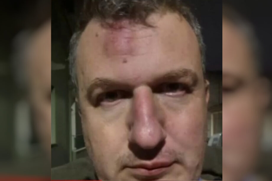 Ποιους καταγγέλλει για τον ξυλοδαρμό του ο εκδότης της «Μαγνησίας» (βίντεο)