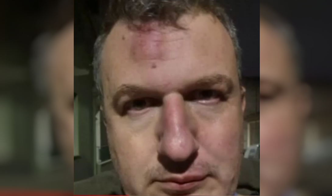 Ποιους καταγγέλλει για τον ξυλοδαρμό του ο εκδότης της «Μαγνησίας» (βίντεο)