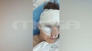 «Μου κάνανε δύο στρώσεις με ράμματα, έχει διαλυθεί το πρόσωπό μου» – Συγκλονίζει η 45χρονη που τραυματίστηκε σε εμπορικό κέντρο