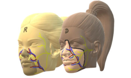 Ισπανία: Πραγματοποιήθηκε η πρώτη μεταμόσχευση προσώπου!