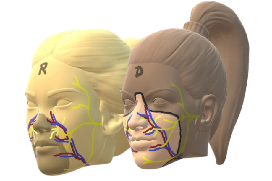 Ισπανία: Πραγματοποιήθηκε η πρώτη μεταμόσχευση προσώπου!