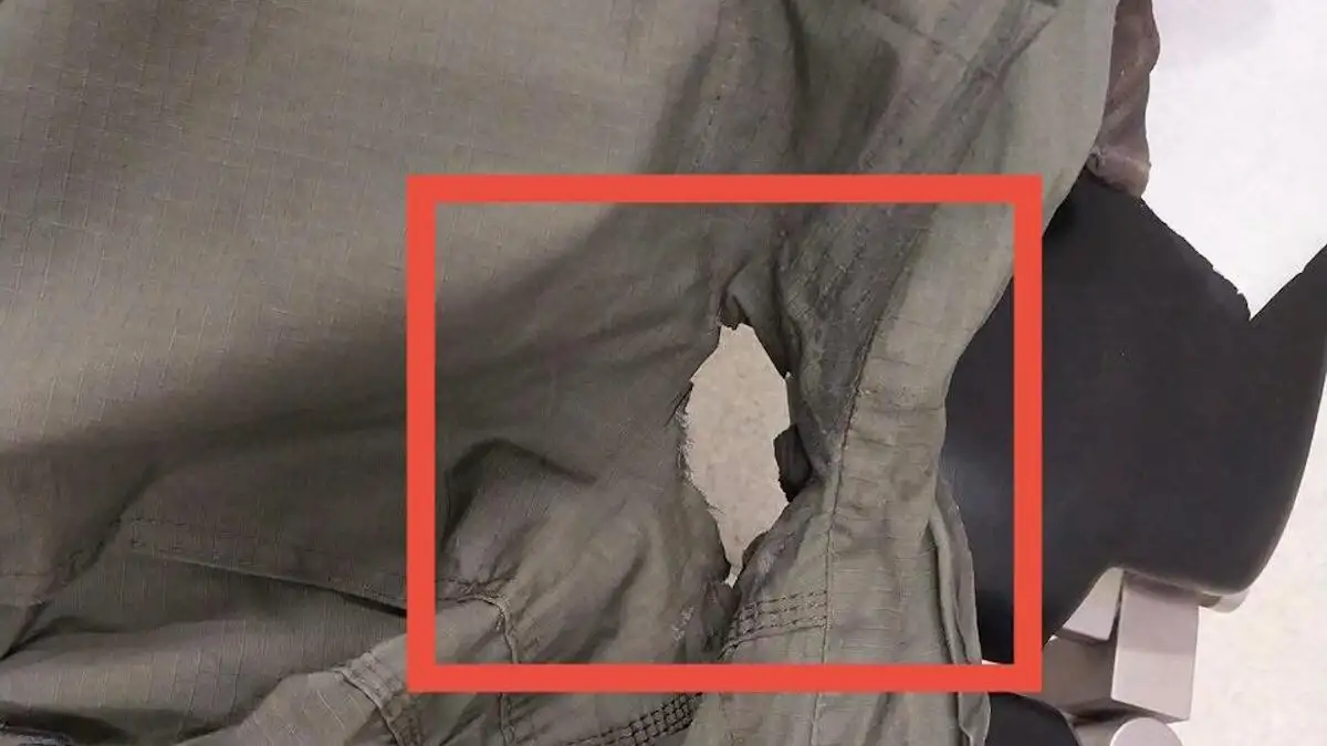 Σοκάρει η στολή του αστυνομικού που δέχθηκε τη βόμβα μολότοφ στο ΑΠΘ (φώτο)